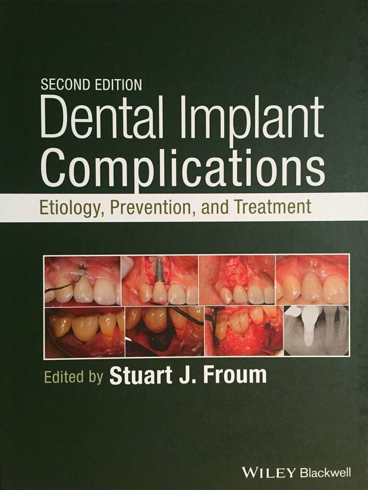 ff_dental_implant_complications